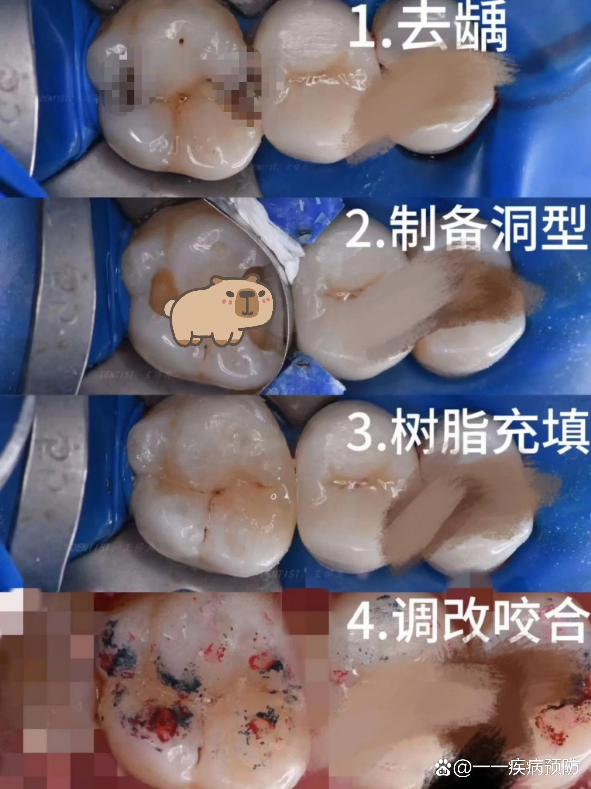 隐形矫正技术：悄然改变你的笑容