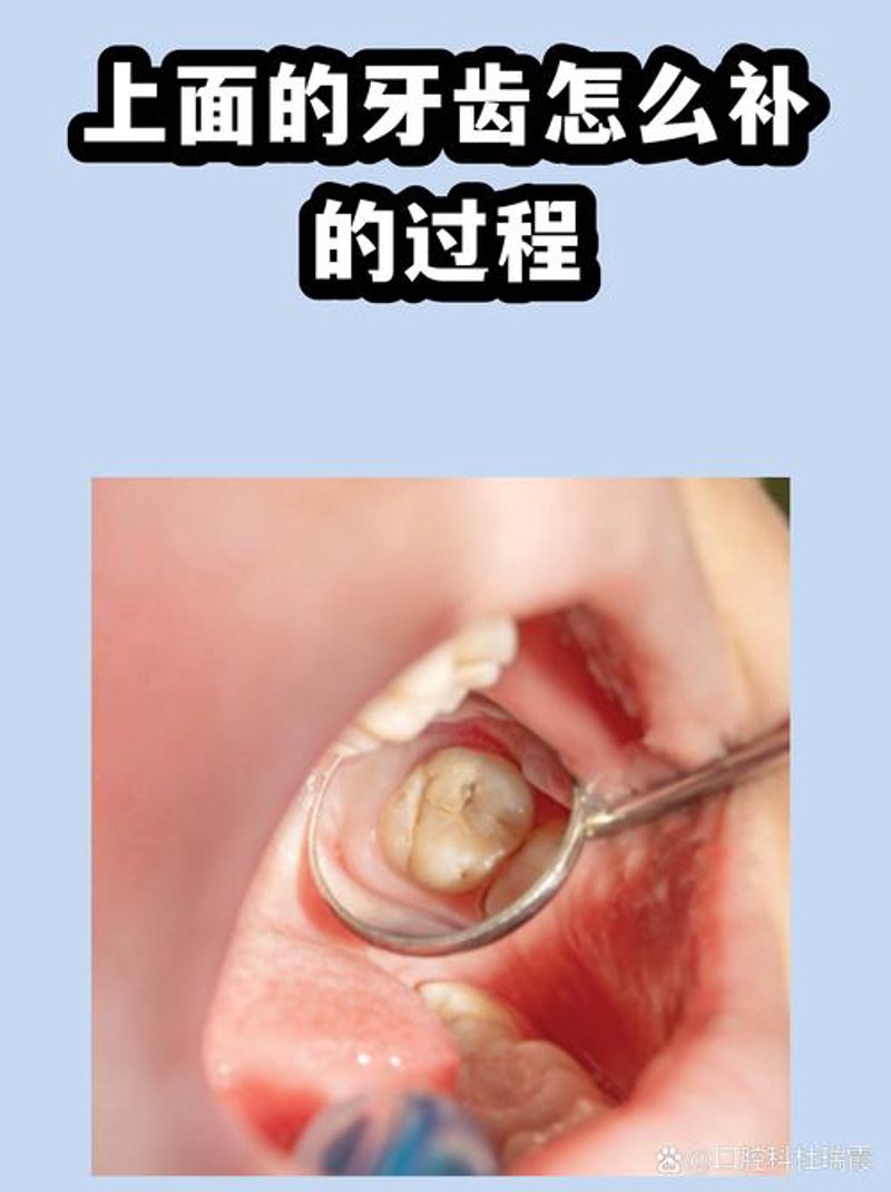 隐形矫正：改变牙齿的秘密武器