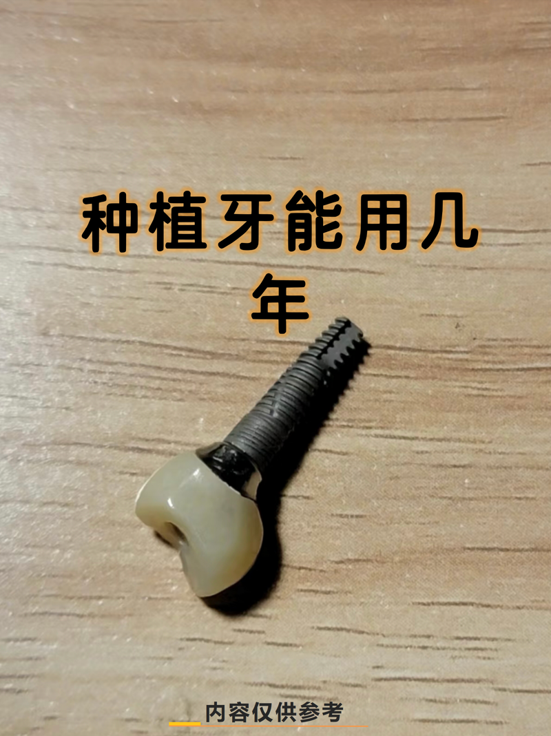 洗牙：守护口腔健康的小秘密