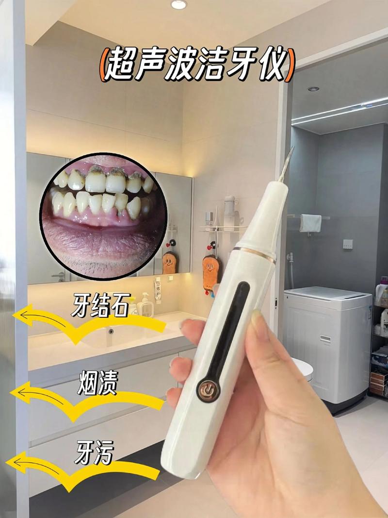 种植牙：种植技巧让牙齿重现光彩